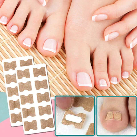 Nagelcorrector – Voor snel herstel en pijnvrije nagels